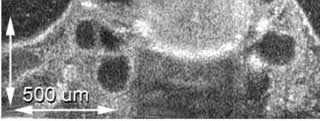 Example of an image obtained by optical coherence tomography (OCT)
